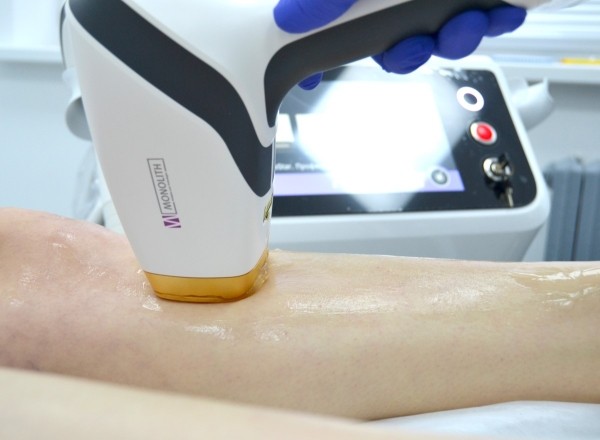 Лазерная эпиляция в Бресте: все что вы хотели знать, но боялись спросить Лазерная эпиляция в Бресте: все что вы хотели знать, но боялись спросить