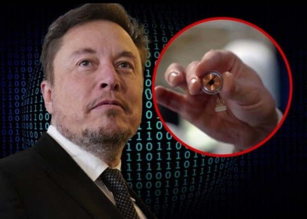 Компания Илона Маска Neuralink вживила первый имплант в мозг человека